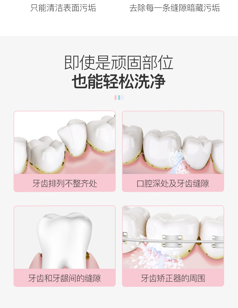 罗曼迷你型洗牙器