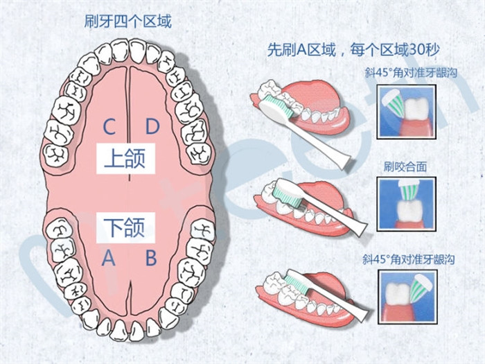 口腔清洁